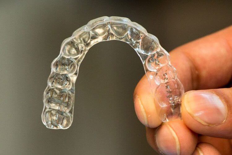 How Do Aligners Align Your Teeth? Clear Aligners