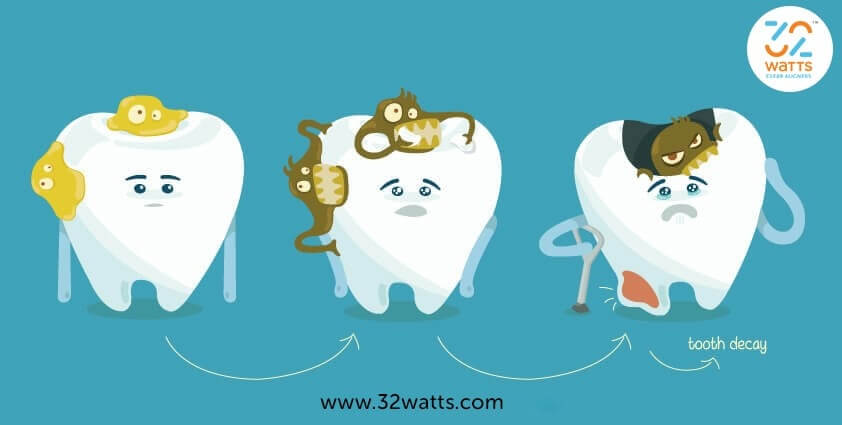 How long does 32 Watts Aligner take to Straighten Teeth ?