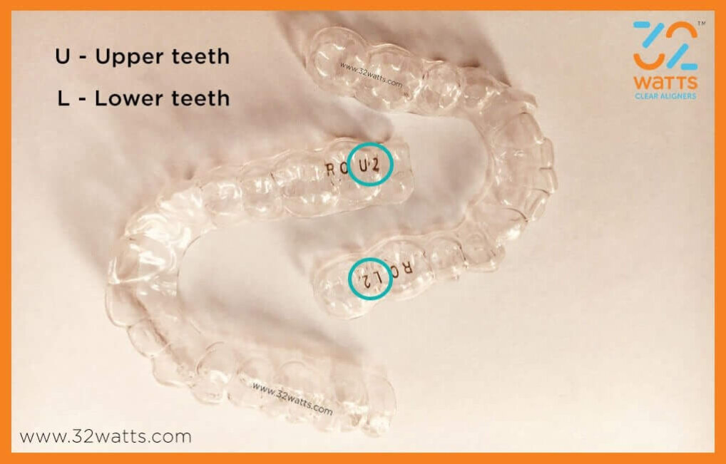 clear aligners in India