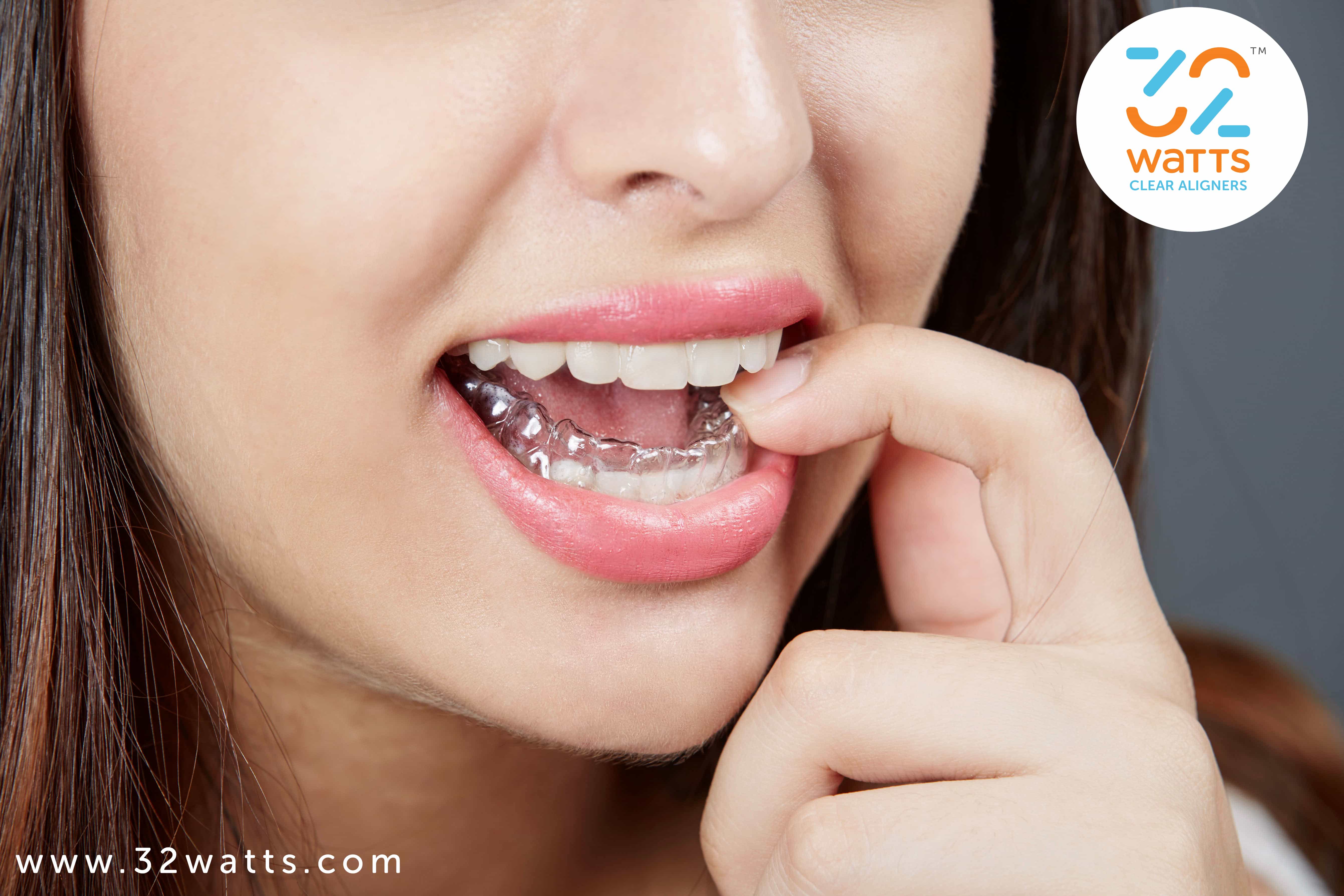 https://www.32watts.com/blog/wp-content/uploads/2019/07/Invisible-Braces-Cost-In-India.jpg
