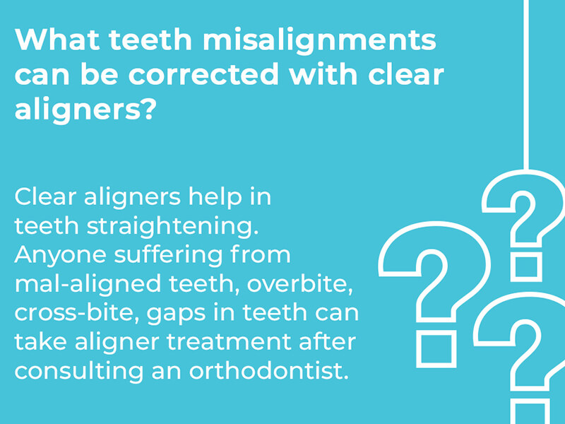 Teens Increasingly Use Clear Aligners in 2022