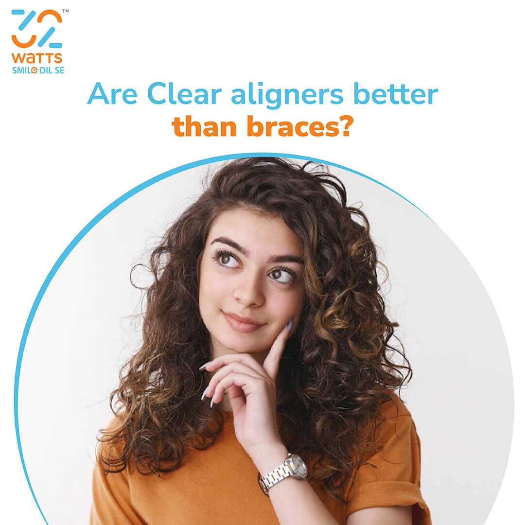 Why Most Are Clear Aligners Better Than Braces - 32watts.com