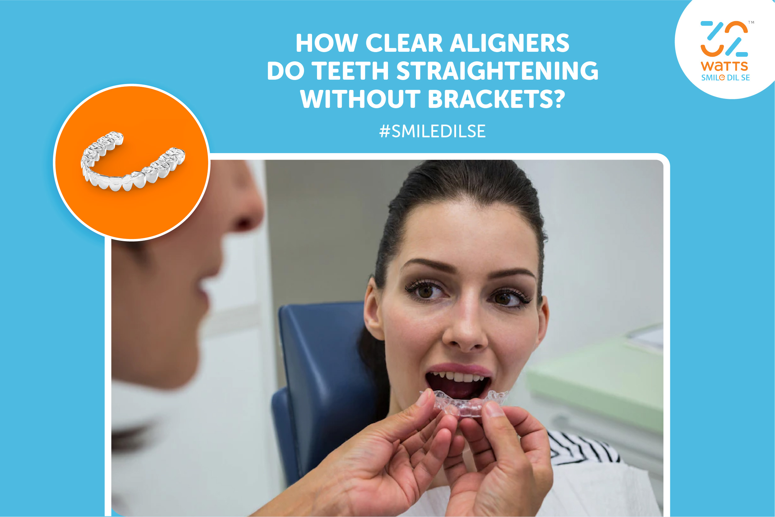 How clear aligners do teeth straightening without brackets?