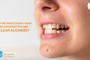 Can all malocclusion cases be corrected through clear aligners