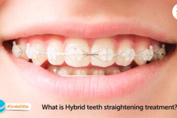 What is Hybrid teeth straightening treatment?