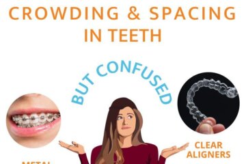Why teeth Aligners or Invisible braces are more in demand than Metal braces?