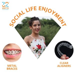 Why Teeth Aligners Or Invisible Braces Are More In Demand Than Metal Braces?