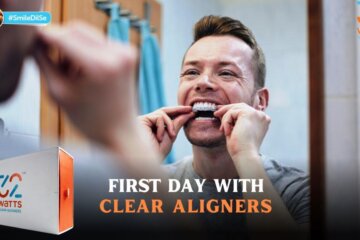 How to handle First Day with Clear Aligners