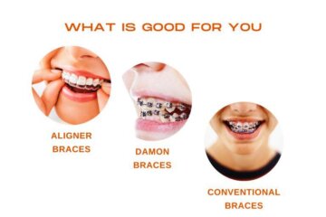 Confused as to which teeth alignment treatment to choose from?