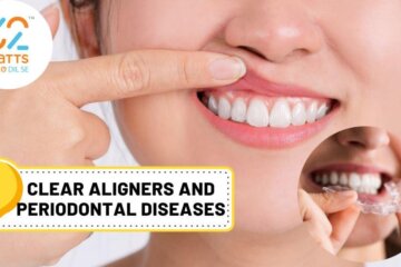 How clear aligners prevent periodontal diseases